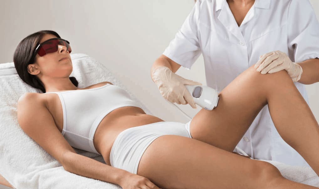 depilazione laser donna