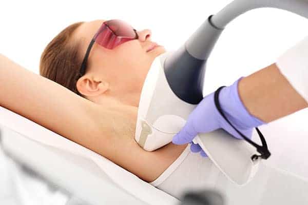 depilazione laser per donna