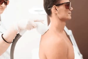 Depilazione laser