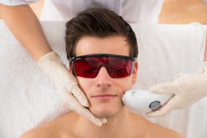 Depilazione laser