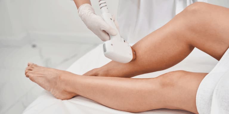 trattamento di epilazione laser donna su gambe
