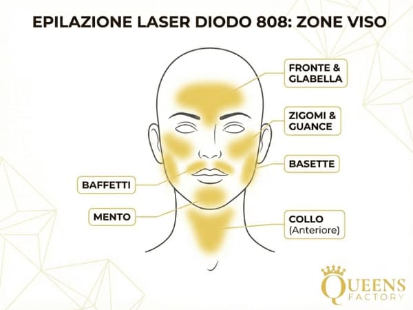 Mappa delle zone trattabili con laser diodo sul viso: fronte, basette, baffetti, mento e collo.