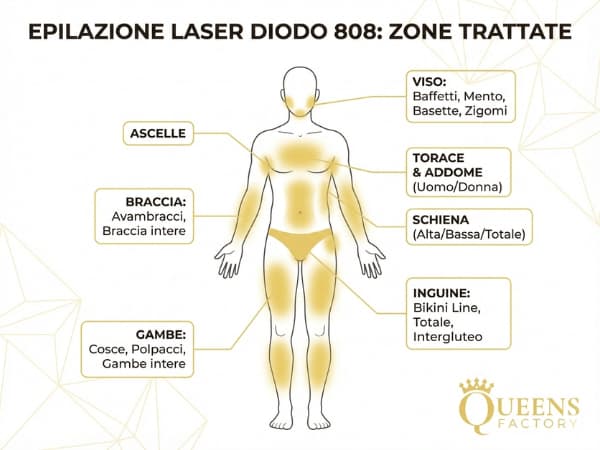 Infografica completa delle zone corpo per epilazione laser diodo 808 uomo e donna presso Queens Factory.